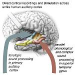 What's the Auditory Cortex?