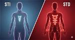 What's the Difference Between Std and Agm?