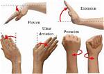 What's Ulnar Deviation Mean?