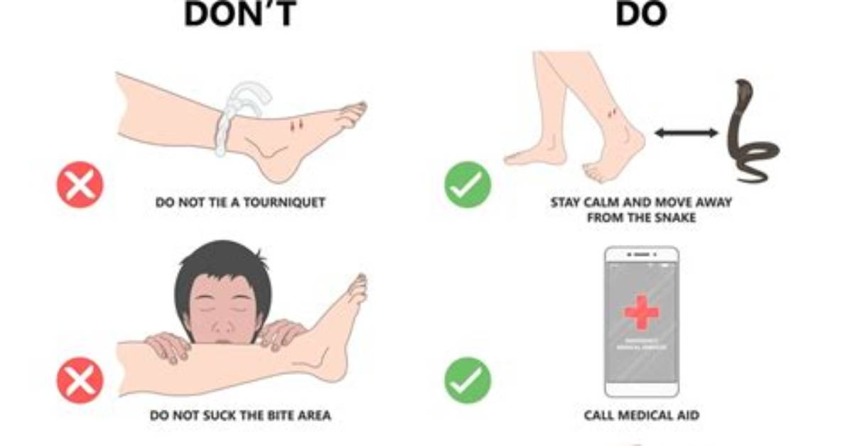 What Should We Do When Snake Bite?