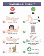 What Should We Do When Snake Bite?