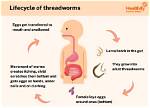 What Threadworms Look Like?
