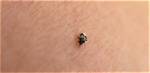 What Tiny Black Bugs Bite?