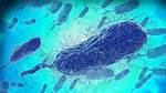 What to Know About the Bacteria Behind the Pneumonia Outbreak in Ohio and China – Healthline