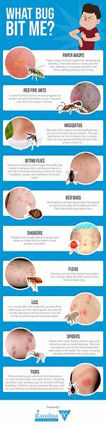 When a Bug Bite Blisters?