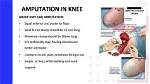When Amputation Is Necessary?