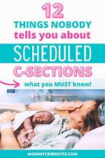When Are C Sections Scheduled?