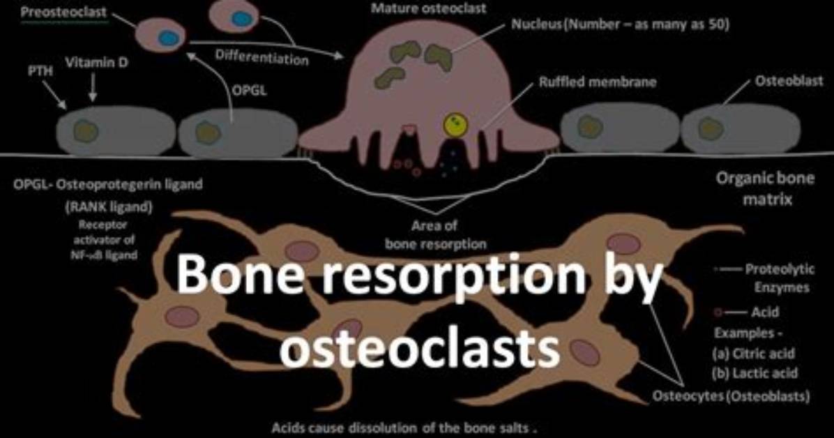 When Bone Is Resorbed?