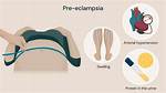 When Can U Get Pre Eclampsia?