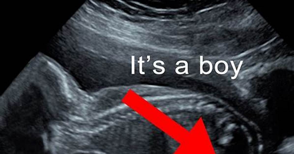When Can You Get a Sonogram?