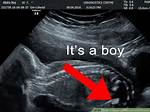 When Can You Get a Sonogram?
