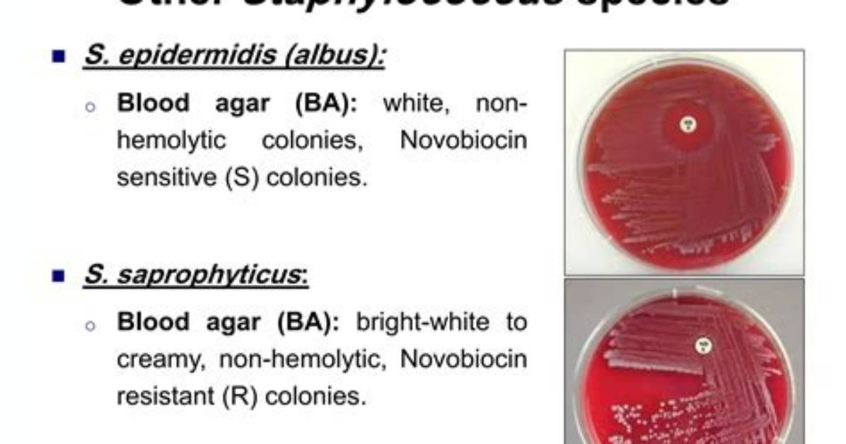 When Did Staphylococcus Start?