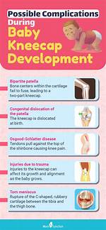 When Do Babies Develop Kneecaps?