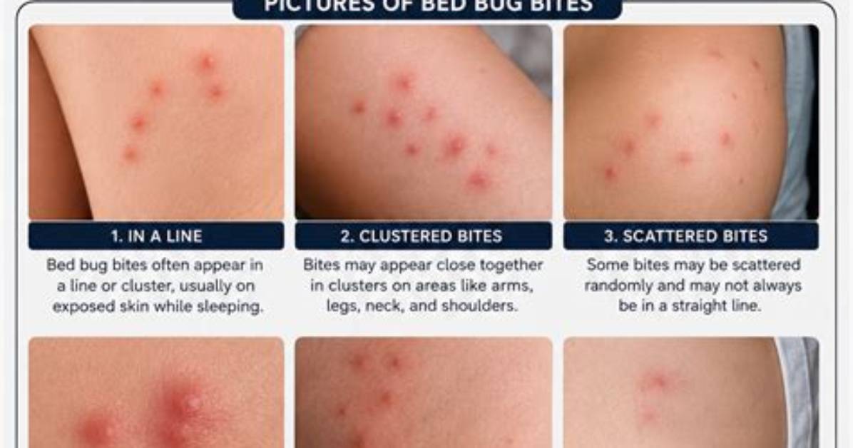 When Do Bed Bug Bites Appear?