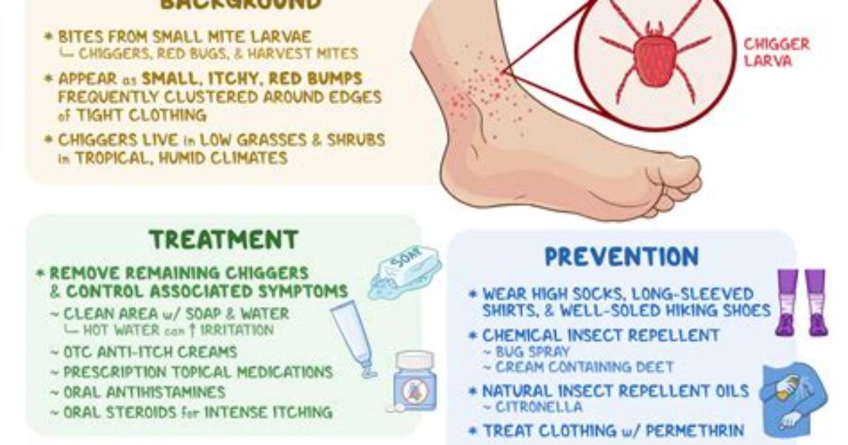 When Do Chigger Bites Itch?