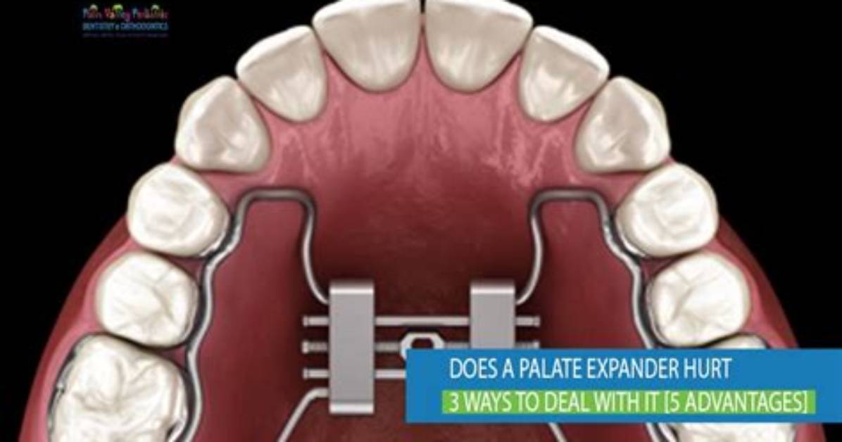 When Do Expanders Hurt?