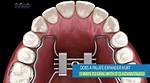 When Do Expanders Hurt?
