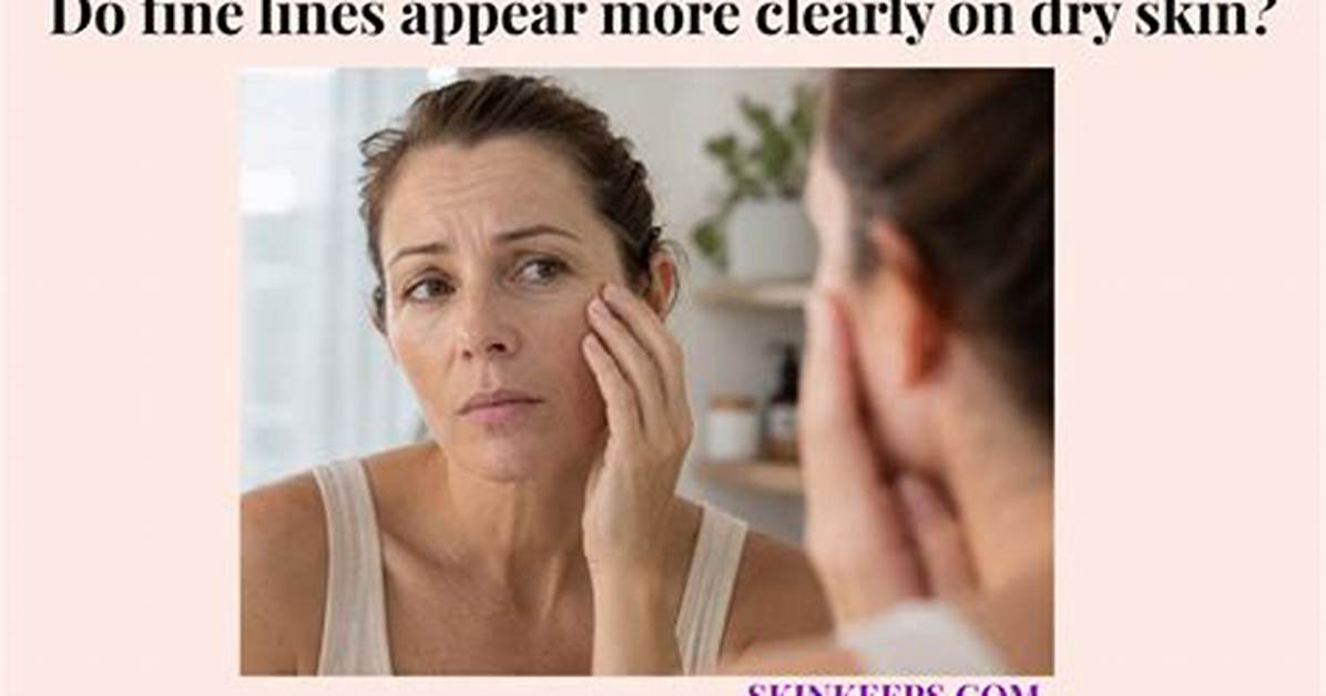 When Do Fine Lines Start Appearing?