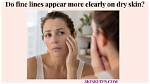 When Do Fine Lines Start Appearing?
