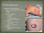 When Do Hemangiomas Stop Growing?