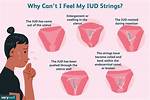 When Do Iuds Fail?