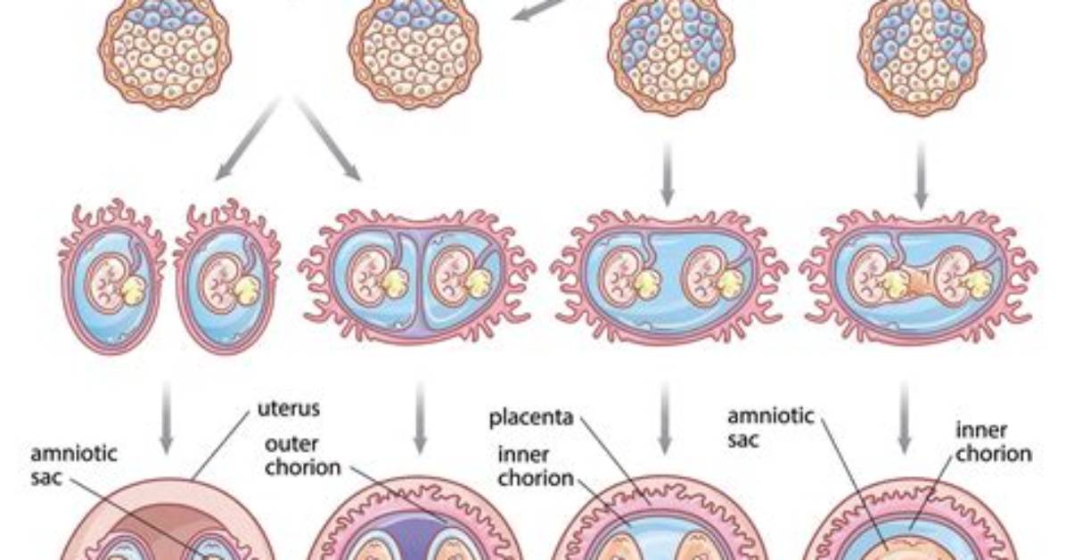 When Do Monozygotic Twins Split?
