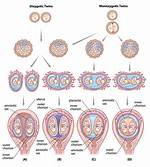 When Do Monozygotic Twins Split?
