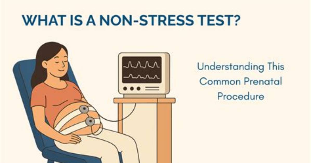 When Do Nsts Start?