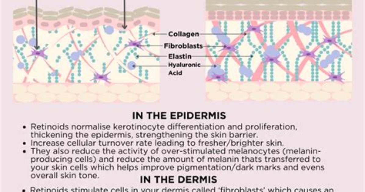 When Do Retinoids Start Working?