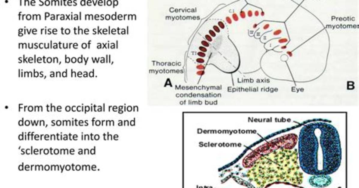 When Do Somites Disappear?