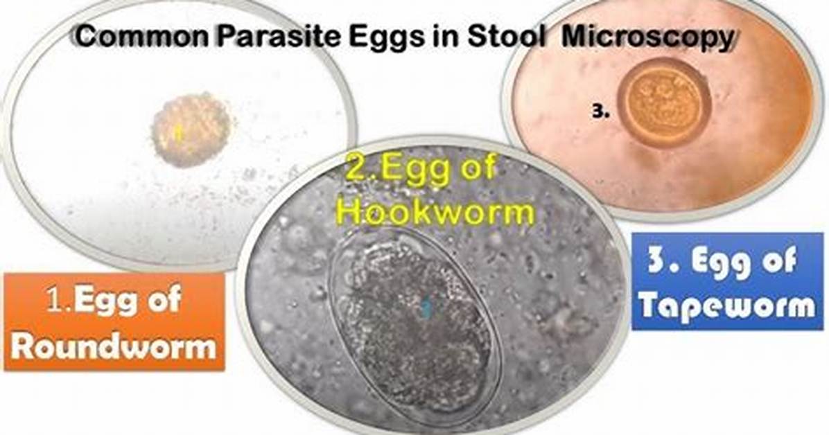 When Do Threadworm Eggs Hatch?