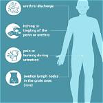 When Do Urethritis Symptoms Start?