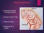 When Do Vasospasms Occur?