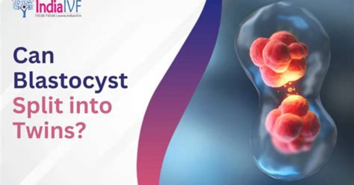 When Does a Blastocyst Split into Twins?