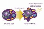 When Does a Cell Become Senescent?