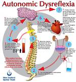 When Does Autonomic Hyperreflexia Occur?