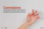 When Does Convulsions Occur?
