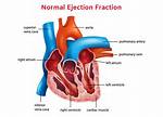 When Does Ejection Period Occur?
