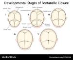 When Does Fontanel Close?
