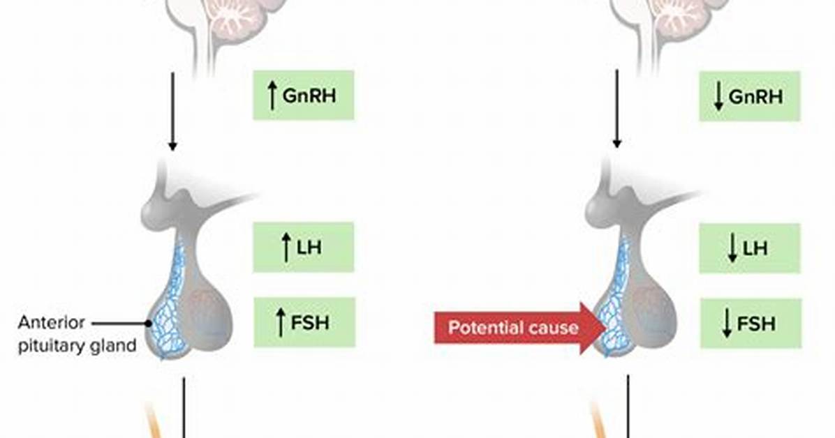 When Does Hypogonadism Start?