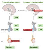 When Does Hypogonadism Start?