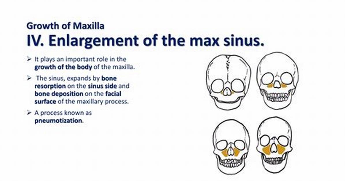 When Does Maxillary Growth Stop?
