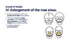 When Does Maxillary Growth Stop?