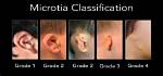 When Does Microtia Occur?