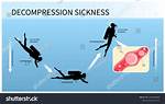 When Does Narcosis Occur?