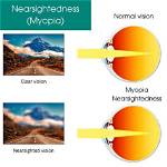 When Does Nearsightedness Stop?