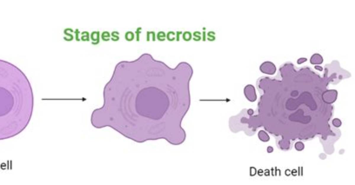 When Does Necrosis Occur?