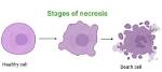 When Does Necrosis Occur?