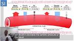 When Does Oncotic Pressure Decrease?