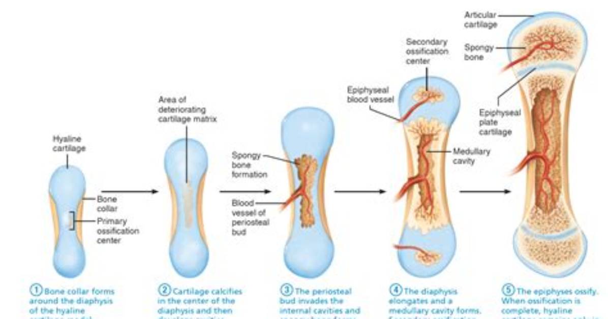 When Does Ossification Happen?